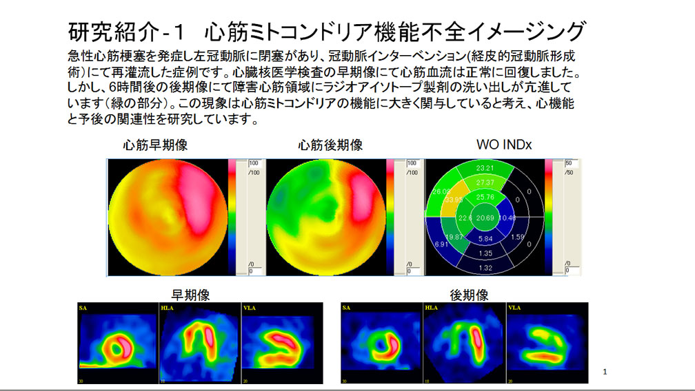 心筋ミトコンドリア機能不全イメージング