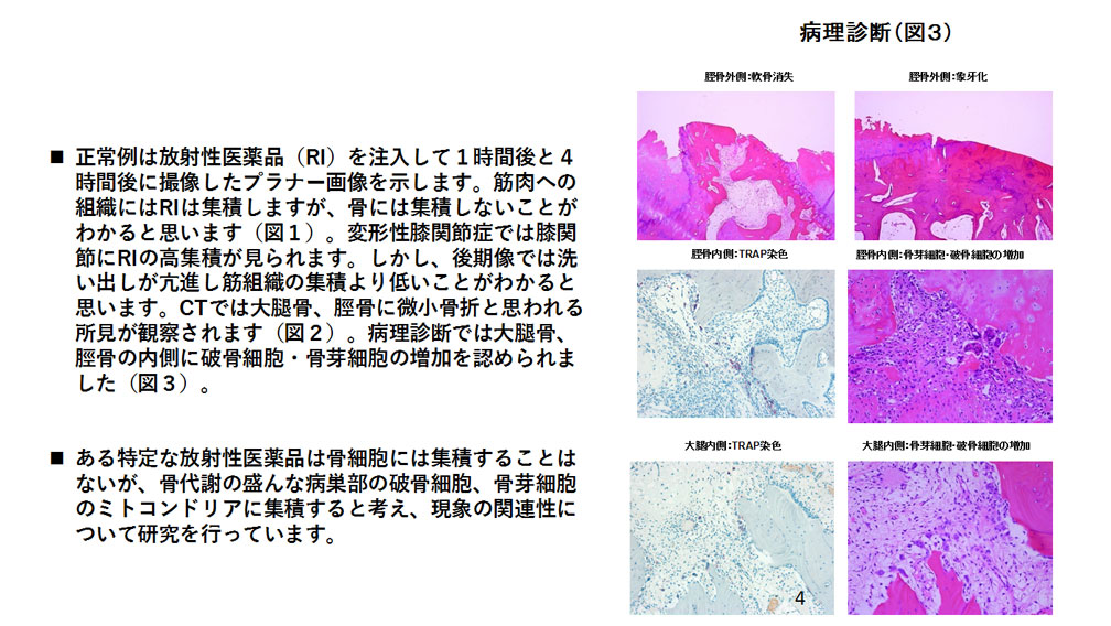 変形性膝関節症のミトコンドリアイメージング